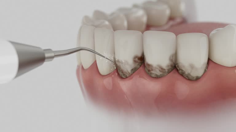 Reliable Dental Implants contractor in Glen Allen, VA by Smile Center Dentistry